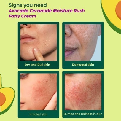 Plix Avocado Ceramide Moisture Rush Fatty Cream